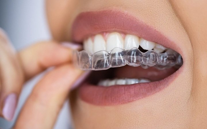 Straightening Your Smile: Orthodontic Solutions For The Whole Family