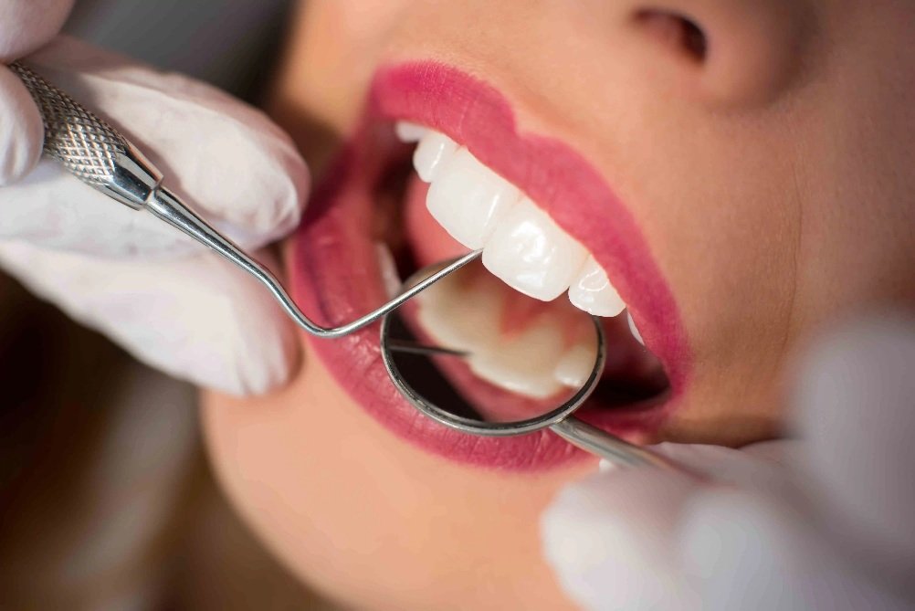 How To Keep Your Teeth Healthy Between Dentist Visits