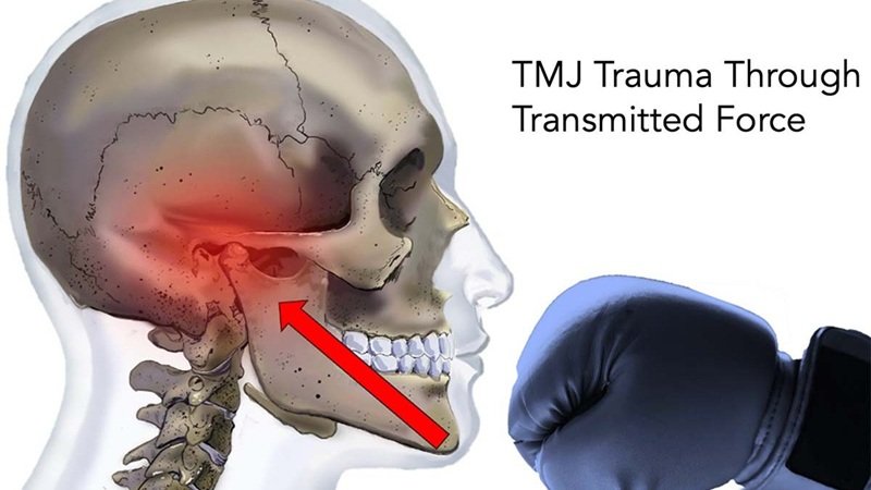 Understanding The Importance Of Jaw Screening In Preventing Tmj Disorders