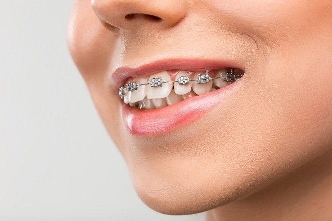 Why Early Orthodontic Records Matter For Future Family Treatment