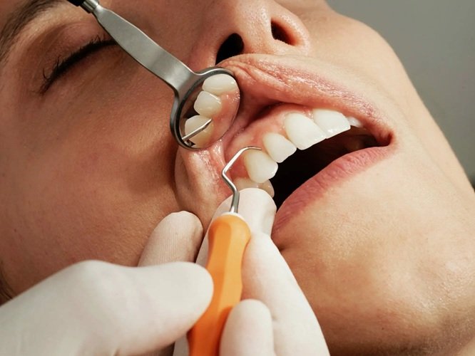 4 Practical Preventive Tools Every Family Dentist Uses