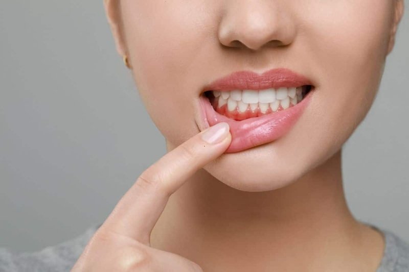 3 Signs You May Need Periodontal Treatment