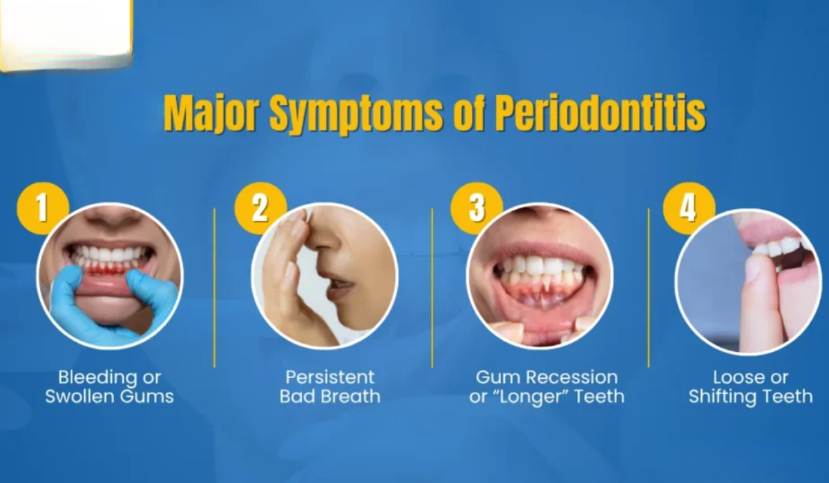 3 Signs You May Need Periodontal Treatment