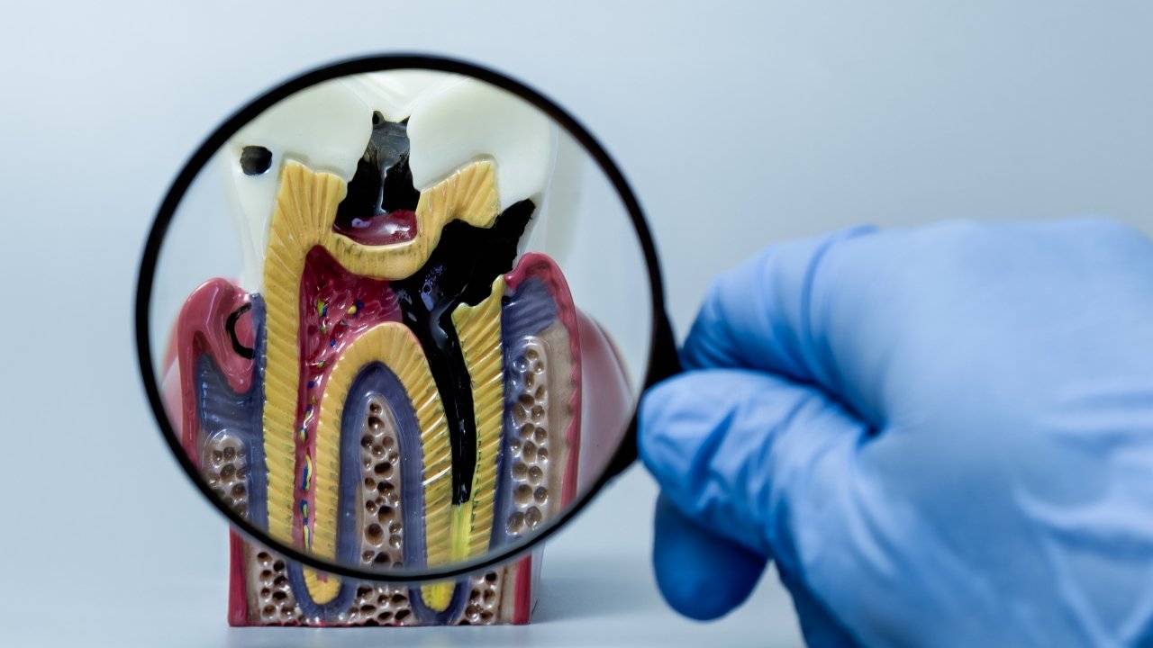 How Preventive Dentistry Detects Problems Before They Become Expensive